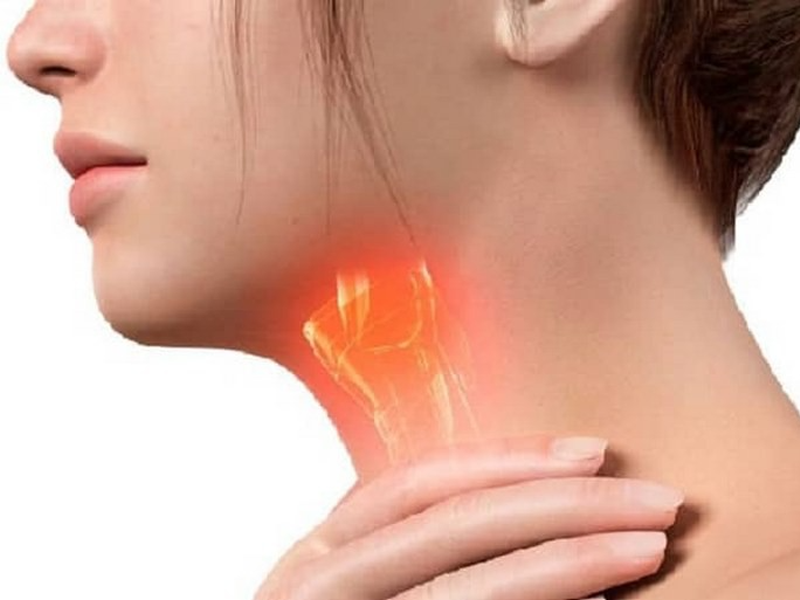 Polyp ở dây thanh quản