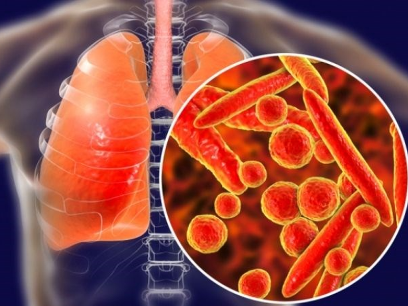 kham-tinh-hoan-phat-hien-lao-phoi