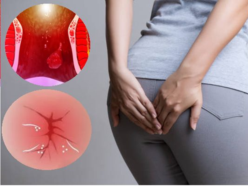 khoi-tri-khien-san-phu-khong-the-ngoi-cho-con-bu